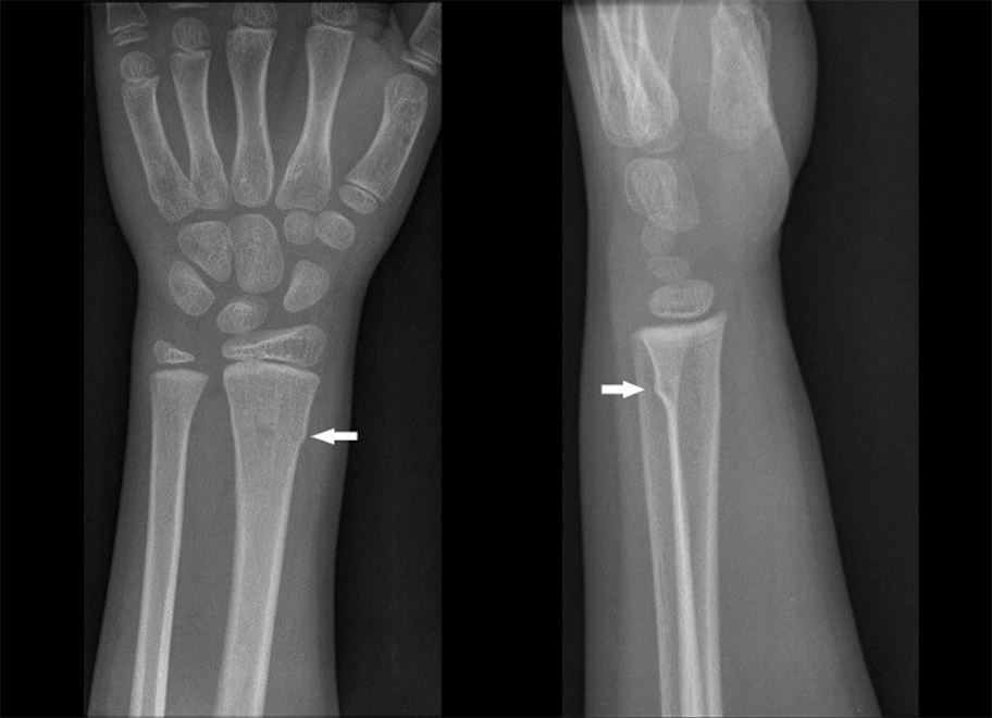 X-ray 