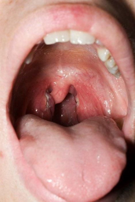 Throat