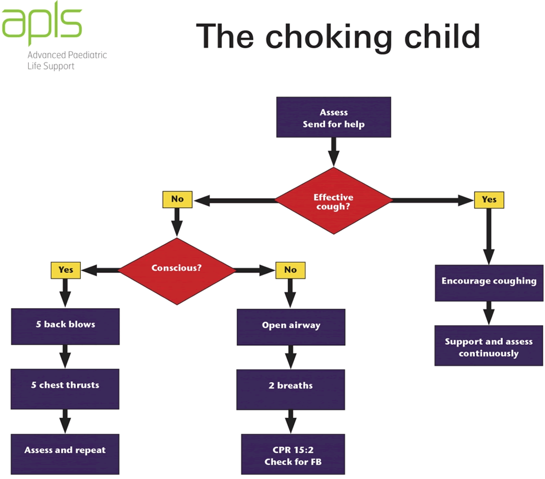 APLS flowchart showing emergency management of choking child