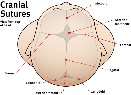 Craniosynostosis Children s Health Queensland