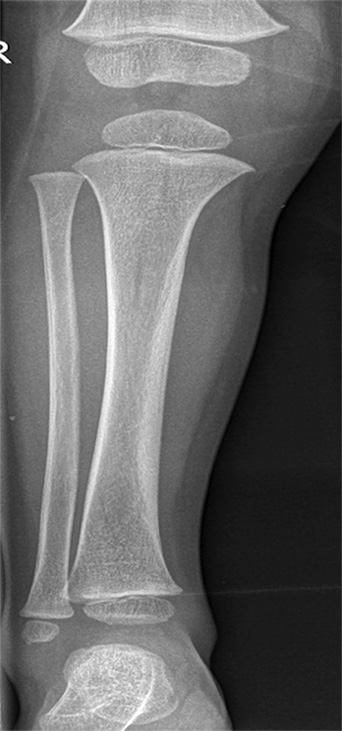 X-ray presentation case 4