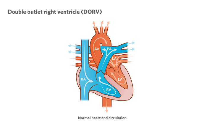 Illustration of normal heart and circulation